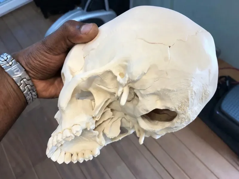 3D printed anatomical human skull with removable calvarium