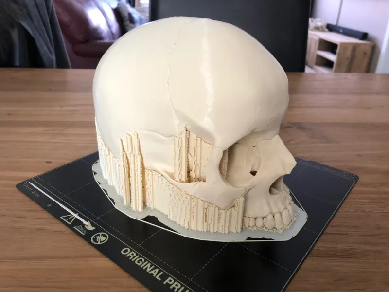 3D printed anatomical human skull base view