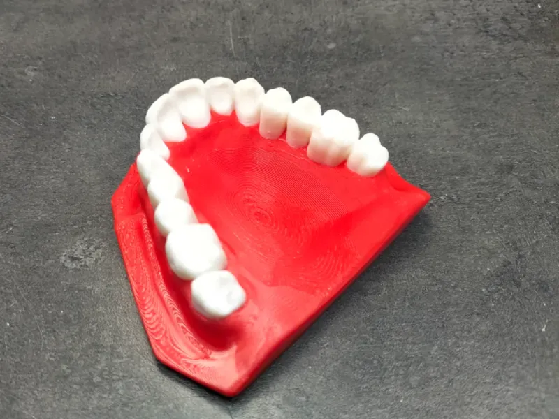 3D printed human maxilla model front view