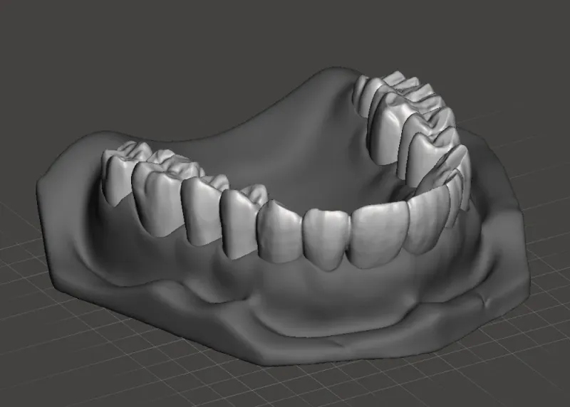 3D printed human maxilla model occlusal view